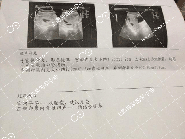 48岁失独妈妈做试管吃闭门羹 巧遇坤和喜得双胎